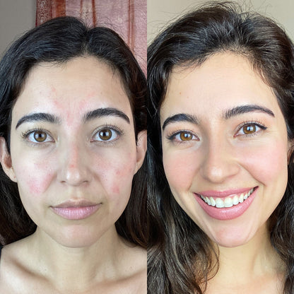 RevitaLight™ Therapy Face Mask