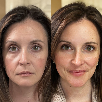 RevitaLight™ Therapy Face Mask