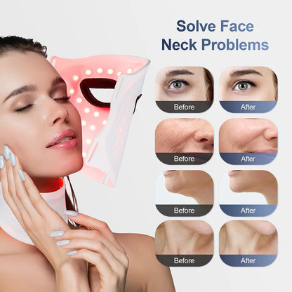 Solacura™ Face Sculpt Mask
